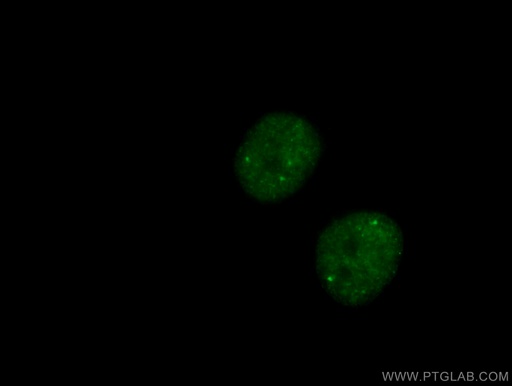 [27106-1-AP-150UL] CCDC124 Polyclonal antibody