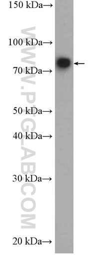 [27108-1-AP-150UL] SHCBP1L Polyclonal antibody