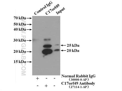 [27114-1-AP-150UL] C17orf49 Polyclonal antibody