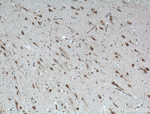 [27117-1-AP-150UL] PTN Polyclonal antibody