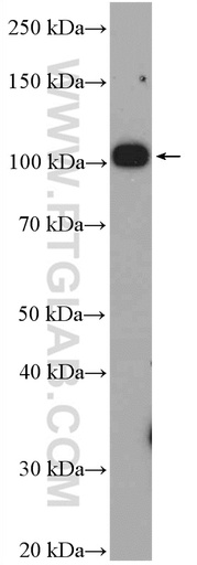 [27132-1-AP-150UL] Nesprin 3 Polyclonal antibody