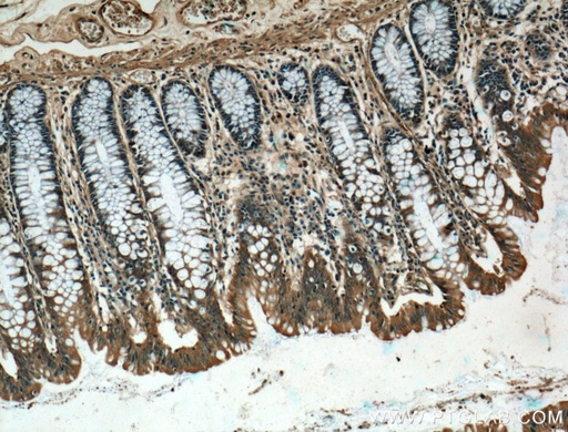 [27133-1-AP-150UL] CARMIL Polyclonal antibody