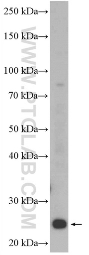 [27134-1-AP-150UL] C9orf142 Polyclonal antibody