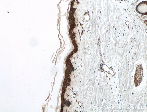 [27141-1-AP-150UL] EGF Polyclonal antibody