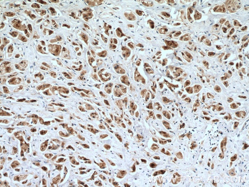 [27147-1-AP-150UL] SGSM3 Polyclonal antibody