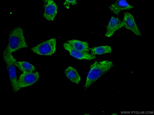 [27151-1-AP-20UL] DOCK4 Polyclonal antibody