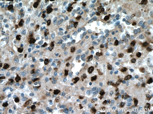 [27153-1-AP-150UL] PRTN3 Polyclonal antibody