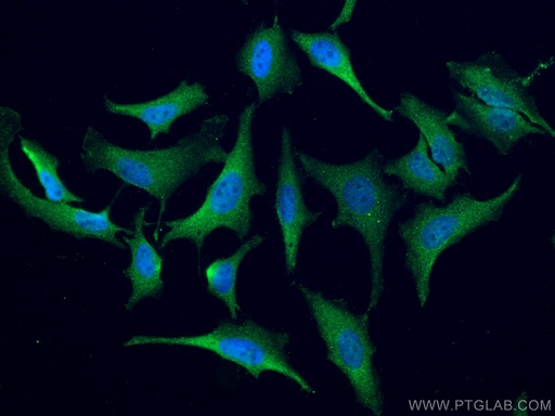 [27156-1-AP-20UL] ATM Polyclonal antibody