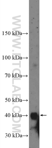 [27157-1-AP-150UL] ZFPL1 Polyclonal antibody