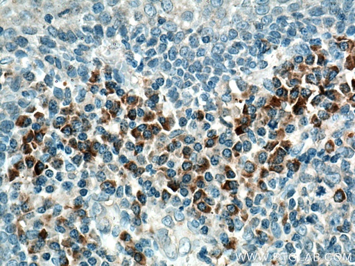 [27163-1-AP-150UL] IL-23R Polyclonal antibody