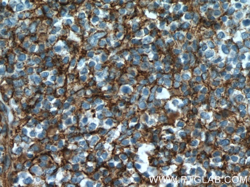 [27171-1-AP-150UL] Nectin 2 Polyclonal antibody