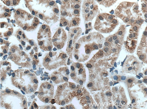 [27174-1-AP-150UL] TMIGD1 Polyclonal antibody