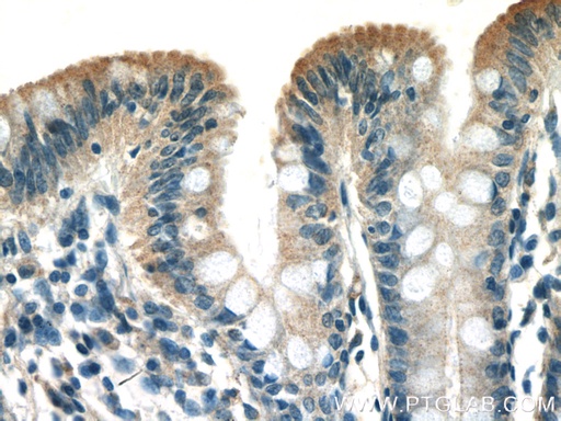 [27176-1-AP-150UL] ST14 Polyclonal antibody