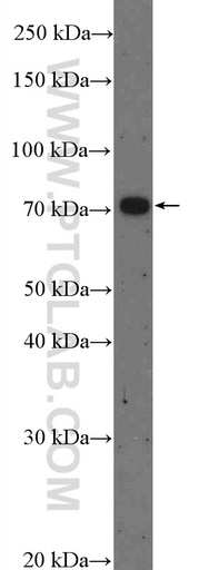 [27179-1-AP-20UL] ZDHHC8 Polyclonal antibody