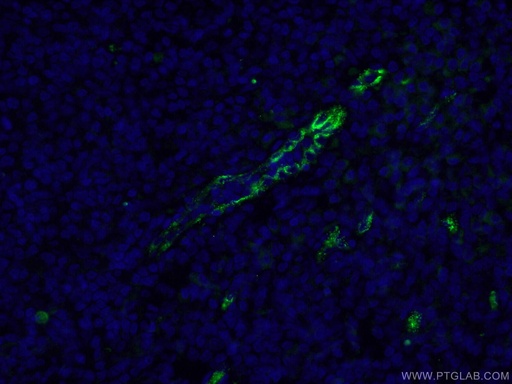 [27186-1-AP-20UL] VWF Polyclonal antibody