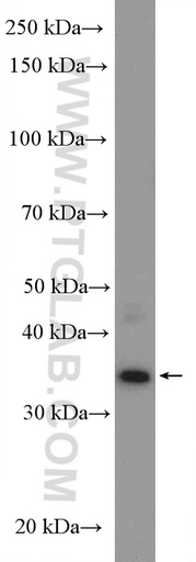[27192-1-AP-150UL] CCDC92 Polyclonal antibody