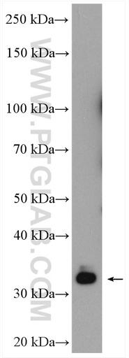 [27195-1-AP-150UL] EHF Polyclonal antibody