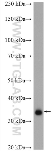 [27201-1-AP-20UL] CCDC137 Polyclonal antibody