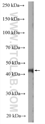 [27203-1-AP-20UL] LMBRD1 Polyclonal antibody