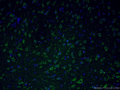 [27206-1-AP-150UL] Huntingtin Polyclonal antibody