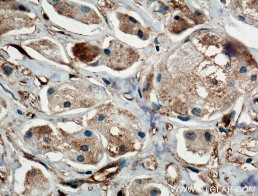 [27207-1-AP-20UL] BDH2 Polyclonal antibody
