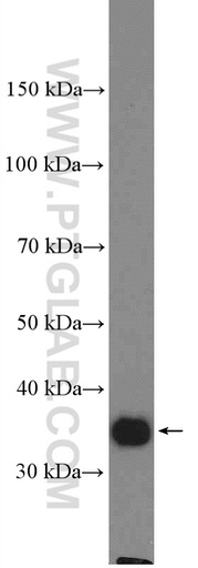 [27208-1-AP-20UL] LRRC59 Polyclonal antibody