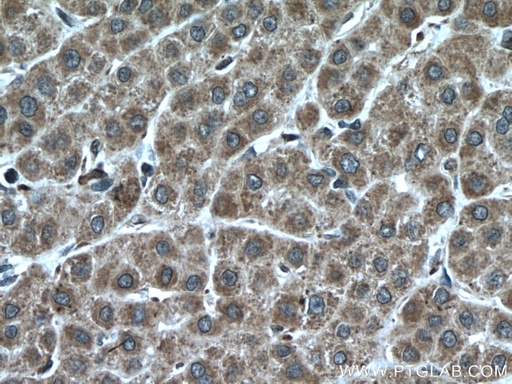 [27210-1-AP-20UL] KIF13A Polyclonal antibody