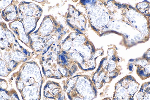 [27212-1-AP-20UL] TGFBR2 Polyclonal antibody