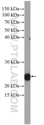 [27213-1-AP-20UL] RHOA Polyclonal antibody