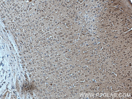 [27218-1-AP-150UL] KIF2A Polyclonal antibody