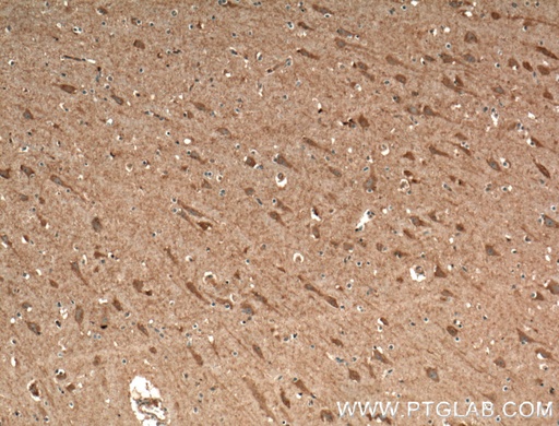 [27225-1-AP-20UL] CACNA1E Polyclonal antibody