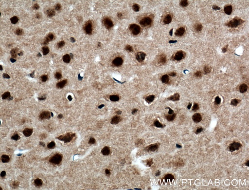 [27226-1-AP-150UL] FTO Polyclonal antibody