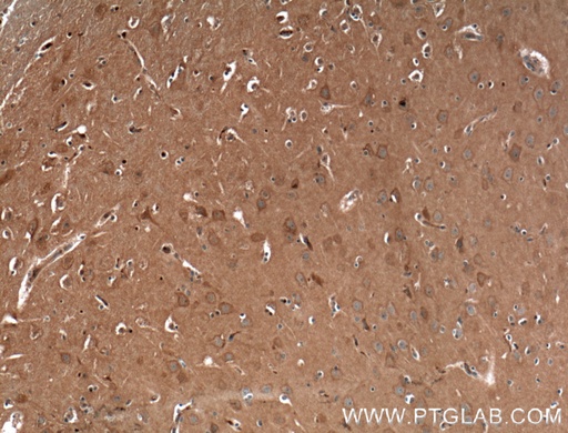 [27227-1-AP-20UL] CACNA1A Polyclonal antibody