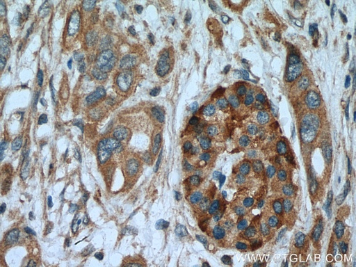[27235-1-AP-150UL] ASIC1 Polyclonal antibody