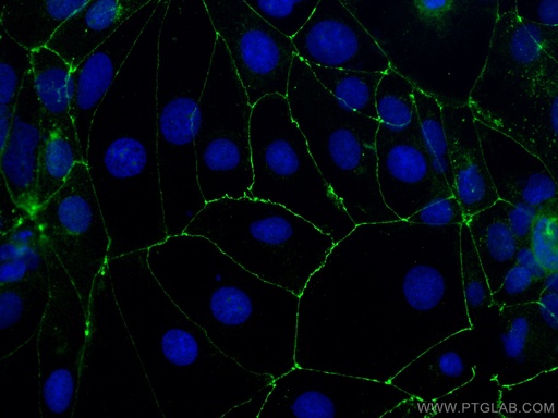 [27260-1-AP-150UL] Occludin Polyclonal antibody