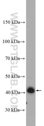 [27270-1-AP-20UL] AS3MT Polyclonal antibody