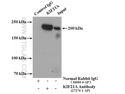[27276-1-AP-20UL] KIF21A Polyclonal antibody