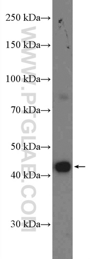 [27277-1-AP-20UL] KLHDC1 Polyclonal antibody