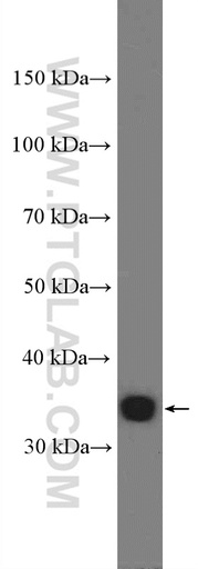 [27279-1-AP-20UL] KCTD10 Polyclonal antibody