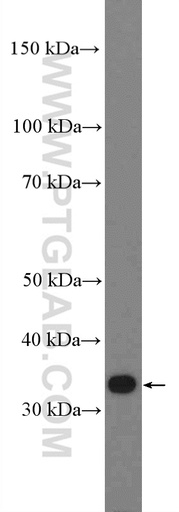 [27285-1-AP-20UL] PPP1R3B Polyclonal antibody