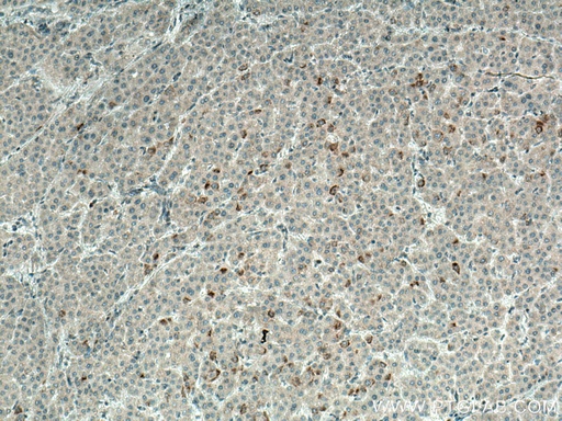 [27286-1-AP-150UL] BCRP,ABCG2 Polyclonal antibody