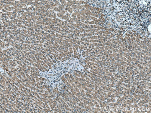 [27293-1-AP-150UL] Chordin Polyclonal antibody