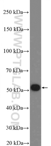 [27294-1-AP-20UL] FBXO31 Polyclonal antibody