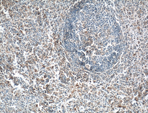 [27299-1-AP-20UL] GBP2 Polyclonal antibody