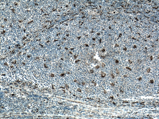 [27306-1-AP-20UL] MMP9 (Middle) Polyclonal antibody