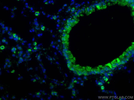 [27308-1-AP-150UL] COX2/ Cyclooxygenase 2/ PTGS2 Polyclonal antibody