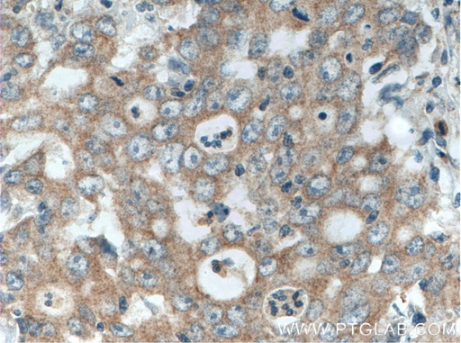 [27310-1-AP-150UL] EDEM3 Polyclonal antibody