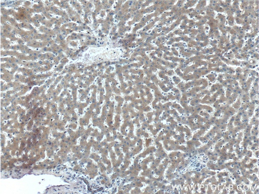 [27315-1-AP-150UL] STAMBPL1 Polyclonal antibody