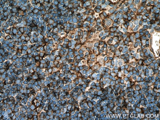 [27319-1-AP-150UL] AAGAB Polyclonal antibody