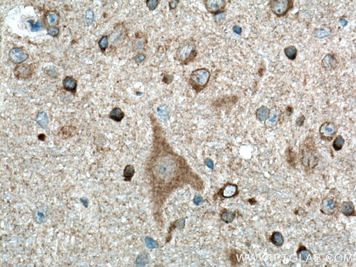 [27320-1-AP-20UL] Beta Amyloid Polyclonal antibody
